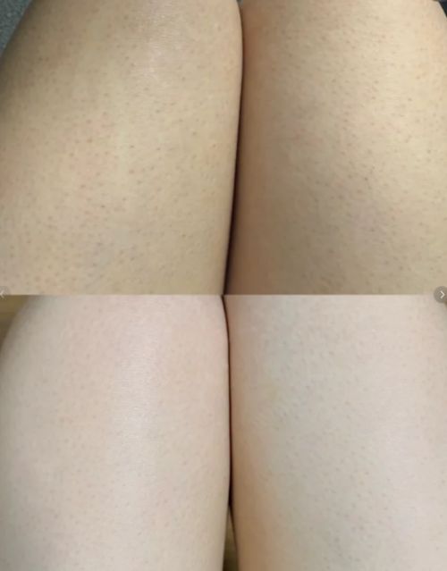 SURRYN素影身体乳锁水修复是冬季肌肤本命AG真人澳门百家家乐身体乳哪个牌子的好用？(图11)